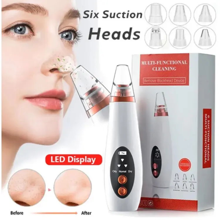 Blackhead Remover