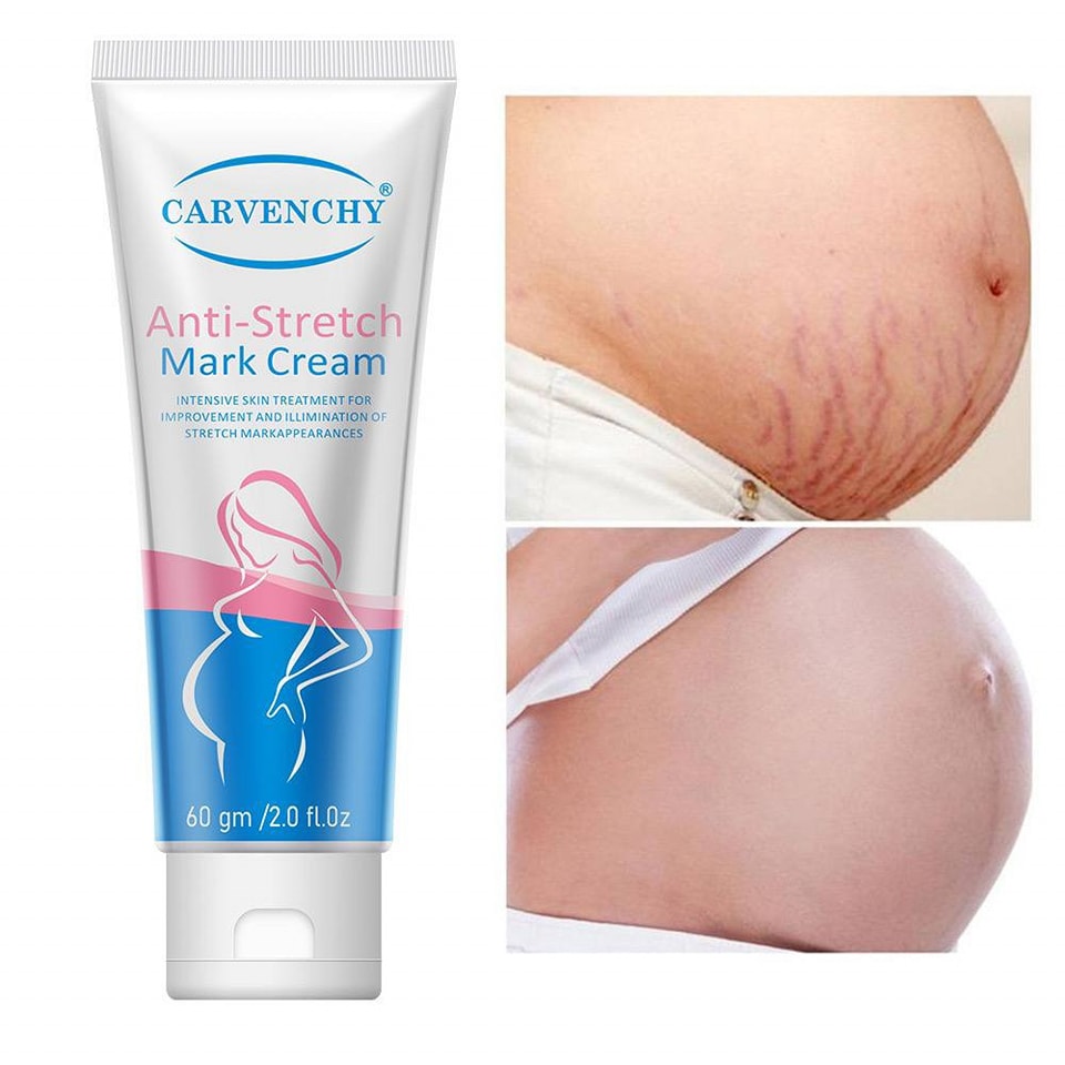 Anti-Stretch Mark Cream Remove Stretch Marks - Image 2