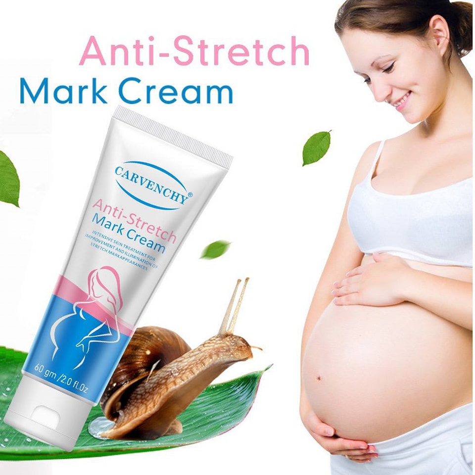 Anti-Stretch Mark Cream Remove Stretch Marks