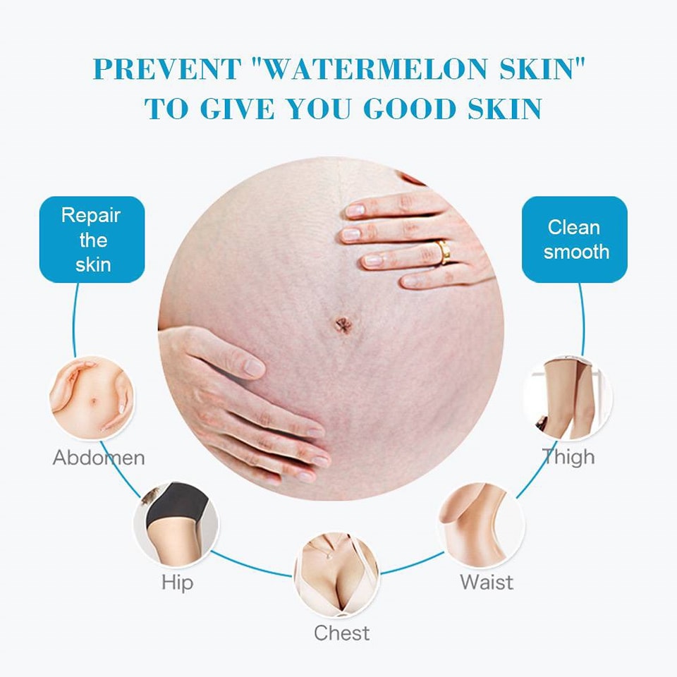 Anti-Stretch Mark Cream Remove Stretch Marks - Image 3