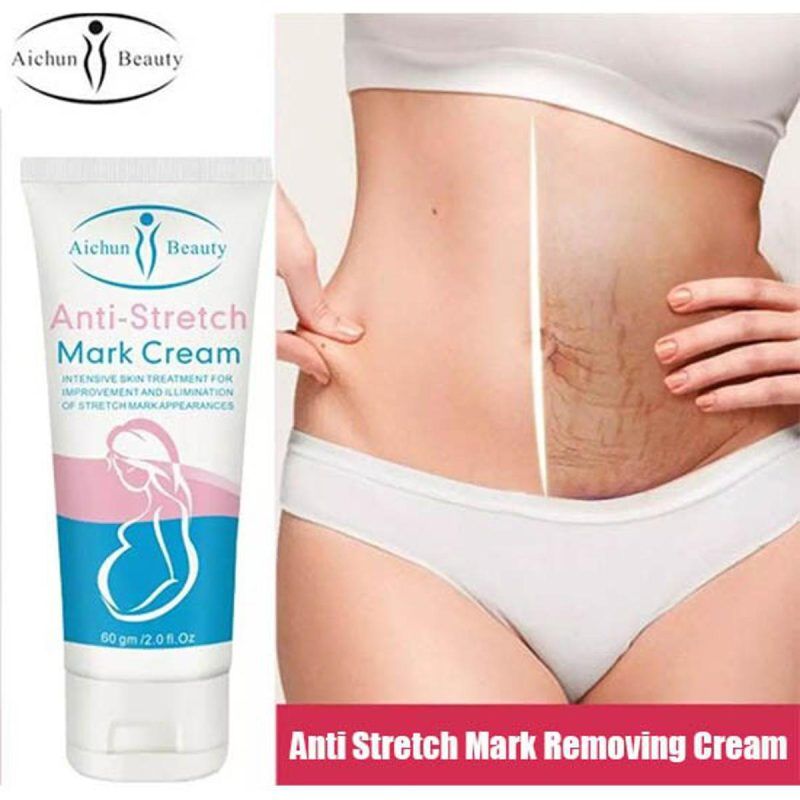 Anti-Stretch Mark Cream Remove Stretch Marks