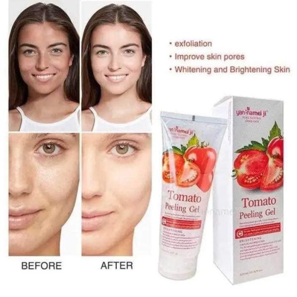 TOMATO PEELING GEL