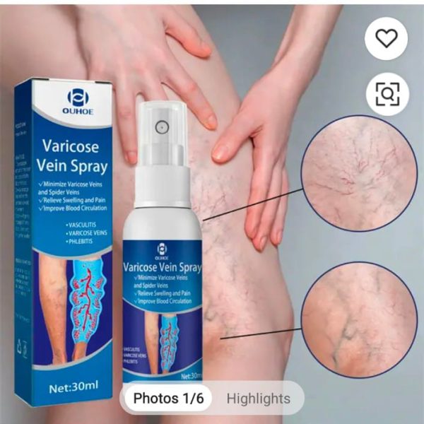 Varicose Vein Treatment Spray