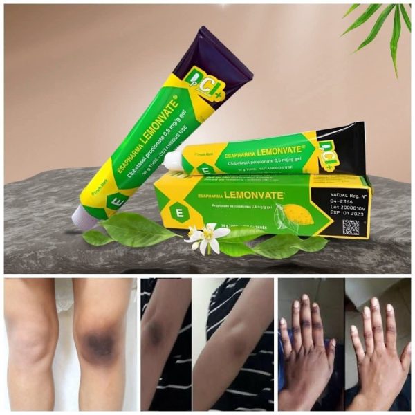 Lemonvate Brightening Cream - Image 2
