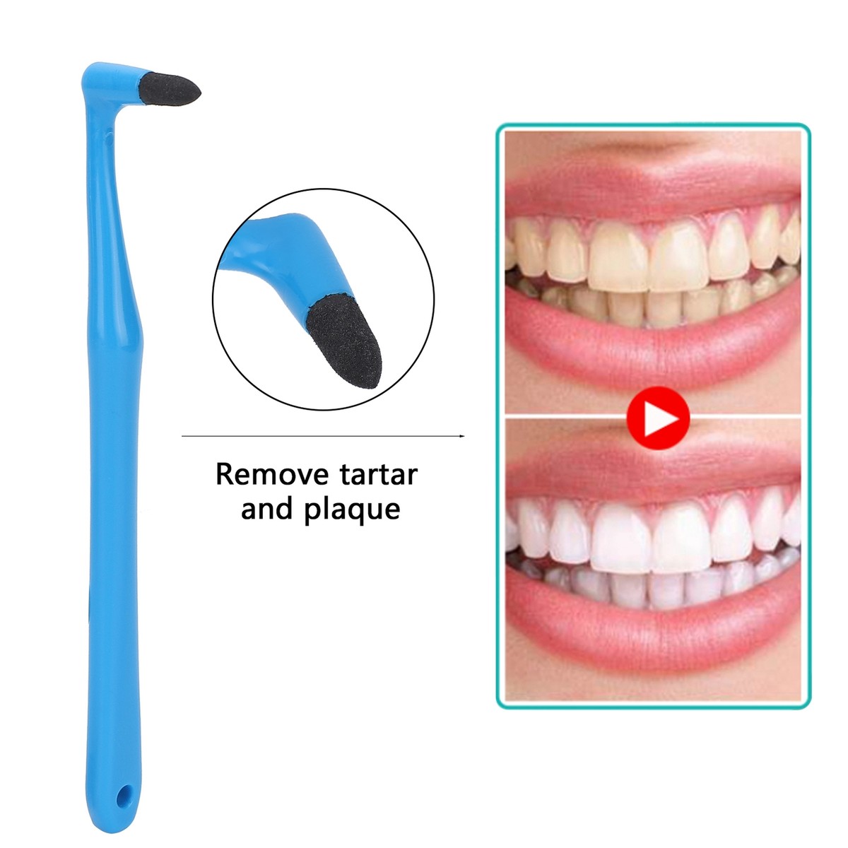 Dental Stain Remover